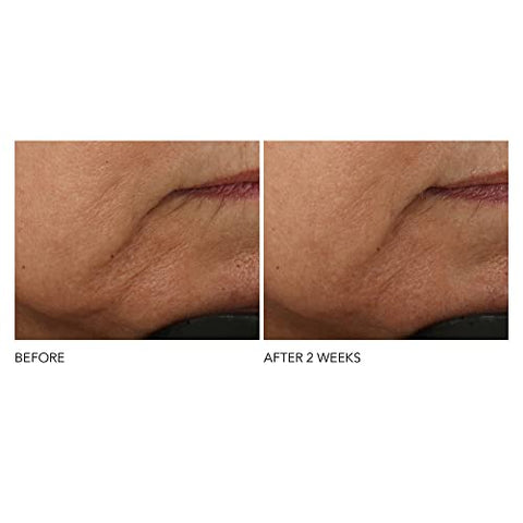Dr Dennis Gross - Dr. Dennis Gross Creme Intensivo de Rugas com Retinol Ferulic Avançado | Hidratação Intensa para Transformar Visivelmente a Pele e Reparar a Barreira de Umidade | 2 oz (60g)