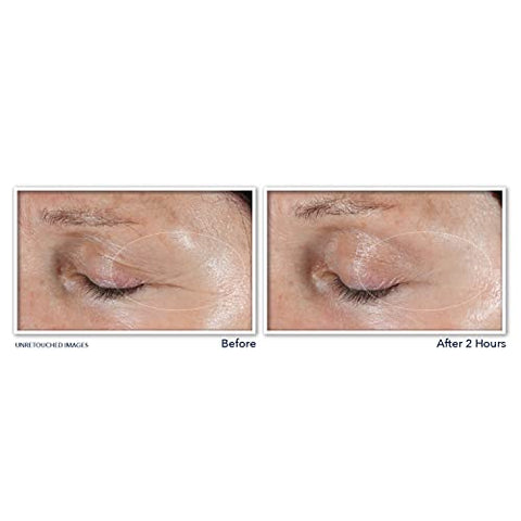 Retinol Correxion Adesivos Não Invasivos para Rugas Profundas com Ácido Hialurônico e Peptídeos Firmadores para Testa, Linhas de Expressão, Pés de Galinha e Risos (6 Adesivos) - RoC