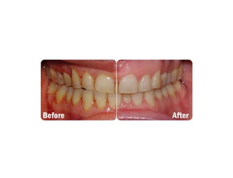ProBiora Health - ProBiora: Probióticos Orais para Dentes e Gengivas | Saúde Oral Melhorada | Tratamento para Mau Hálito em Adultos | ProBiora3 Patenteado | Clareamento Dental | 100% Natural