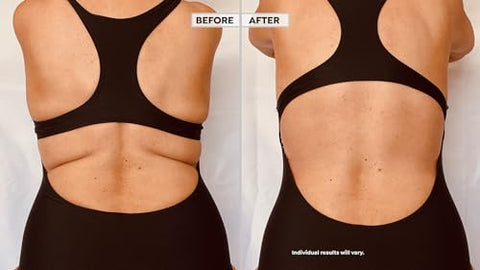 Instant Thigh Lift - Skinnies Instant Lifts – 5 Pares Levanta Costas – PATENTEADO MADE USA REDUZ GORDURA DAS COSTAS INSTANTANEAMENTE Fitas Adesivas Transparentes Suavizam Instantaneamente a Gordura das Costas. Use Decotes nas Costas!