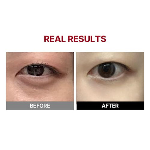 MEDITHERAPY - Creme para os Olhos Wrinkle-fit Tangle, Ponta de Dispositivo Recarregável de Proteína de Colágeno, Tratamento Completo para Olheiras, 20 ml, Massageador para os Olhos (Creme)