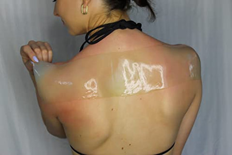 TermaBurn - Aloe Wrap para Alívio de Queimaduras Solares – Novo Tratamento Orgânico de Pele com Aloe em Gel Hidratante para Alívio Duradouro de Dor, Coceira e Descamação. Fabricado nos EUA com 100% de certificação