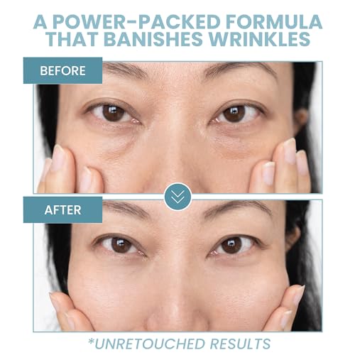 Eva Naturals - Gel Hidratante Luxuoso para os Olhos – Combate Olheiras, Inchaço, Bolsas, Pés de Galinha e Rugas – Com Ácido Hialurônico