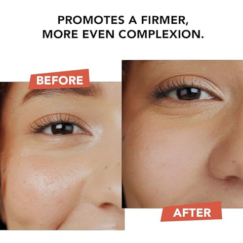 Creme Facial de Vitamina C Hiperativo Anti-Envelhecimento Beauty by Earth – Feito nos EUA com Ingredientes Naturais