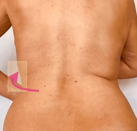 Instant Thigh Lift - Skinnies Instant Lifts – 5 Pares Levanta Costas – PATENTEADO MADE USA REDUZ GORDURA DAS COSTAS INSTANTANEAMENTE Fitas Adesivas Transparentes Suavizam Instantaneamente a Gordura das Costas. Use Decotes nas Costas!