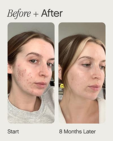 Faded Brightening and Clearing Serum | Reduz Manchas, Marcas Pós-Acne e Descoloração | Com Ácido Kójico e Niacinamida | Testado por Dermatologistas, Vegano | 30ml - Topicals