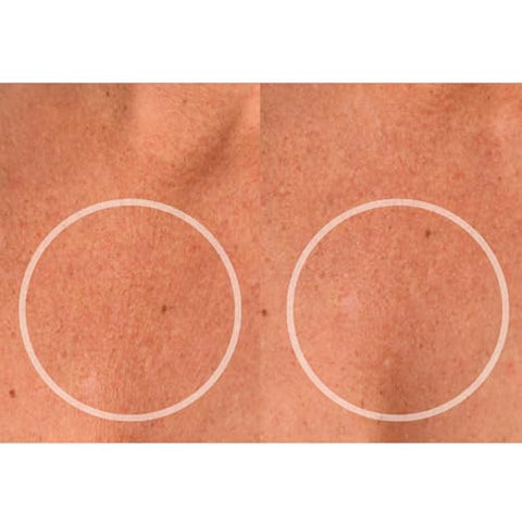 Beauty ChestLift Patches Anti-Rugas (2 Semanas de Fornecimento) – Almofada Reutilizável para Suavizar o Decote Durante a Noite – Adesivo de Silicone Anti-Envelhecimento para o Pescoço - SiO