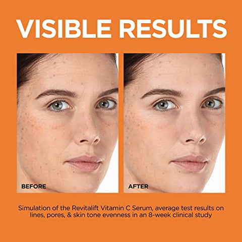 L'Oreal Paris - L’Oreal Paris Revitalift Serum Vitamina C Pura 12%, Vitamina E, Ácido Salicílico, Iluminador 30ml Amostra Hidratante
