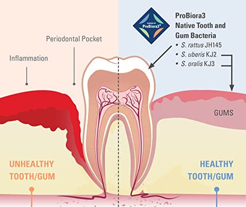 ProBiora Health - ProBiora: Probióticos Orais para Dentes e Gengivas | Saúde Oral Melhorada | Tratamento para Mau Hálito em Adultos | ProBiora3 Patenteado | Clareamento Dental | 100% Natural