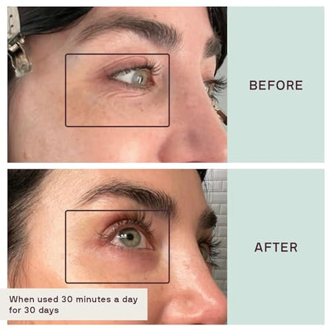 Siliconefusion – Patches de Silicone Reutilizáveis para Olhos e Boca – Hipoalergênicos, Testados por Dermatologistas – Patches de Silicone de Grau Médico para Linhas Finas, Rugas e Cicatrizes – Natural - Dermaclara