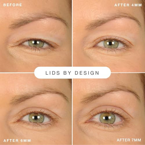 Contours RX - Contours Rx Lids By Design – Fitas Corretoras de Pálpebras de Grau Médico para Olhos Pesados e Encapuzados