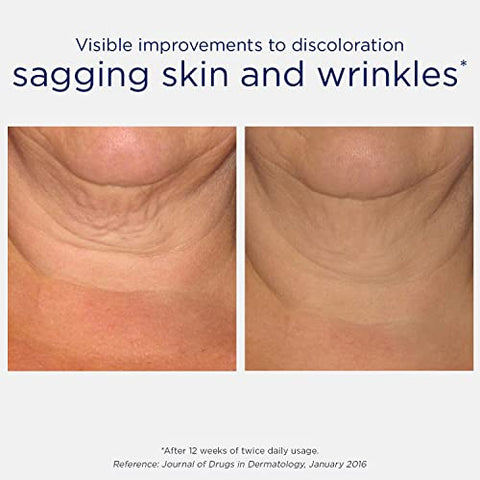 Triple Firming Neck Cream – Creme Rejuvenescedor para Pescoço e Decote com NeoGlucosamina, 80g - NEOSTRATA