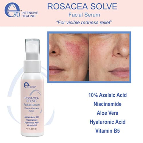 e70 - Conjunto Rosacea Solve – Creme, Soro e Sabonete Facial Hidratante – Ingredientes Benéficos como Aloe Vera, Ácido Hialurônico, Niacinamida e Óleo de Coco