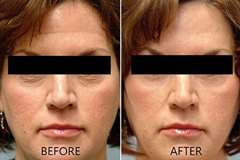 Dr. Brenner - Soro de Vitamina C 20% Ácido L-Ascórbico Puro, Ácido Ferúlico, Vitamina E e Ácido Hialurônico com Vitamina B5 para Rosto e Olhos – Conjunto Natural Anti-Envelhecimento e Anti-Rugas de 2 unidades pela [nome da marca]