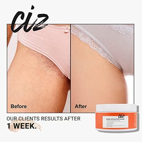 CIZ - Esfoliante para Área do Biquíni, Tratamento para Pelos Encravados e Irritações, Esfoliante de Açúcar, Depilação