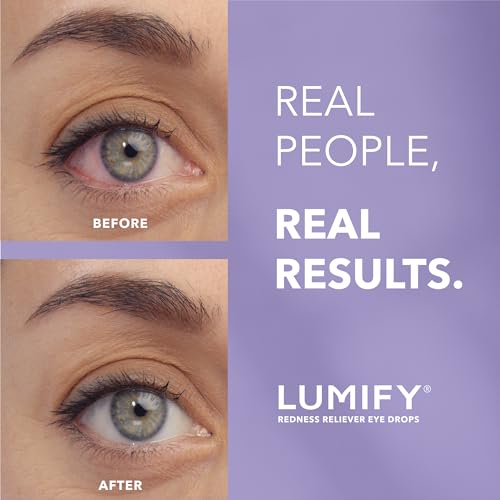 Colírio Redutor de Vermelhidão para os Olhos 5 mL - LUMIFY