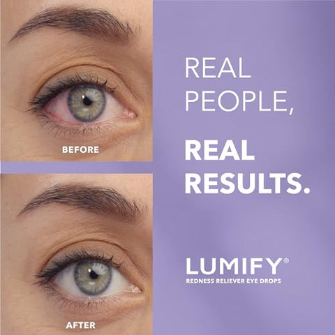 Colírio Redutor de Vermelhidão para os Olhos 5 mL - LUMIFY