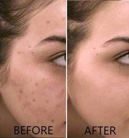 Dr. Brenner - Soro de Vitamina C 20% Ácido L-Ascórbico Puro, Ácido Ferúlico, Vitamina E e Ácido Hialurônico com Vitamina B5 para Rosto e Olhos – Conjunto Natural Anti-Envelhecimento e Anti-Rugas de 2 unidades pela [nome da marca]