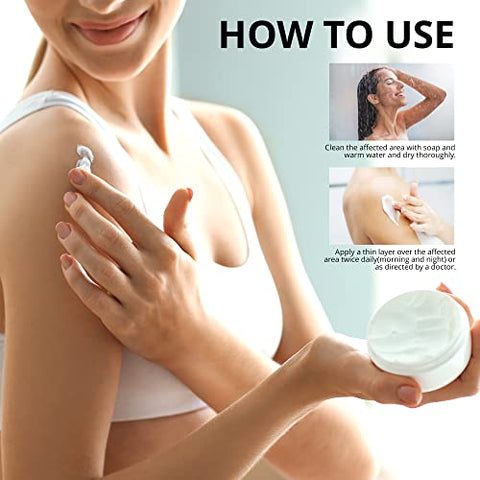 Hermon - Creme Antifúngico Jock Itch, Creme para Psoríase, Tratamento para Micose em Humanos, Tratamento para Psoríase, Tratamento para Couro Cabeludo com Psoríase, Creme para Micose em Humanos, Pés