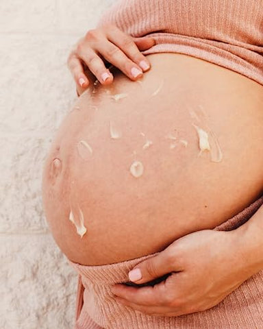 Creme Orgânico para Prevenção e Tratamento de Estrias na Gravidez – Irene Organics: Bálsamo Anti Estrias Premiado para Barriga de Grávida e Pós-parto 120g