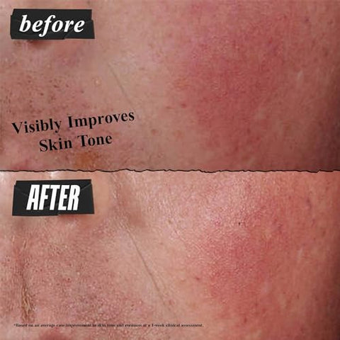 Kiehl’s Creme Reparador Avançado Ultra Facial, Tratamento Intensivo Alivia Pele Seca e Sensível, Reduz Rapidamente Vermelhidão e Acalma, Fórmula Respirável de Absorção Rápida, 50g