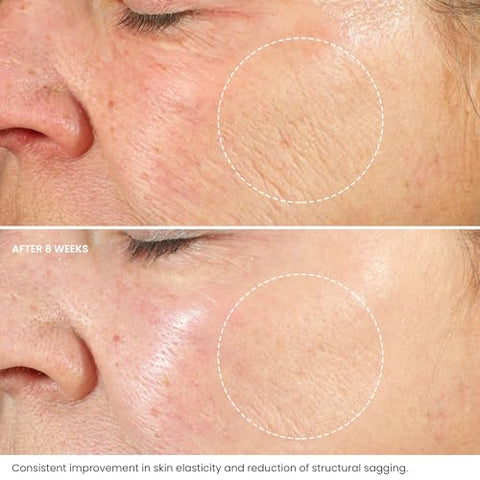 Retinol Moisturizer – 2.5% Retinol e Ácido Hialurônico para Rejuvenescimento Facial e Anti-Envelhecimento – Para Mulheres e Homens | 50g - Kleem Organics