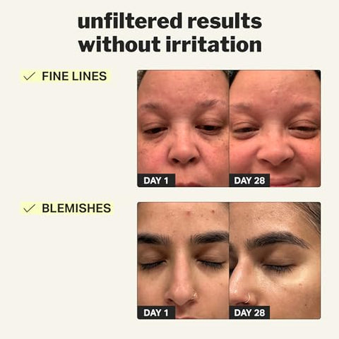 Gel Retinol Iniciante 0,1%, Melhore a Aparência de Linhas Finas e Textura Desigual sem Irritação, Aloe e Cica para Prevenir Ressecamento, 30 ml - Cocokind