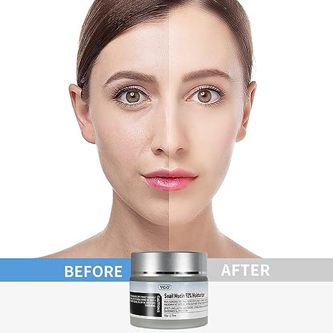 Hidratante Facial Diário VGO Snail Mucin 92% – Gel Reparador Hidratante para o Rosto Seco – 50g