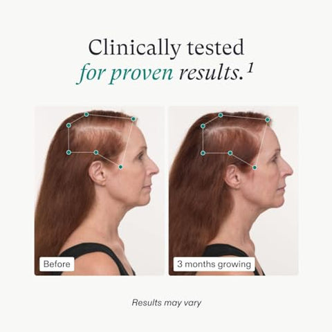Women’s Balance – Crescimento Capilar para Mulheres 45 – Comprovado por Dermatologistas – 90g - Nutrafol