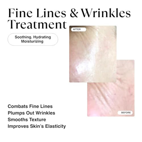 Creme Noturno MATKAS Coreano 0.05%% Retinal para o Rosto – Rugas, Firmeza da Pele, Anti-Envelhecimento – Creme de Retinol para o Rosto Hidratante Noturno – Niacinamida, Ceramida, Ácido Hialurônico