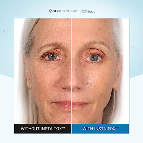 INSTA-TOX – Soro Facial Instantâneo para Suavizar Rugas – Melhora a Aparência de Linhas Finas – 30g - Serious Skincare