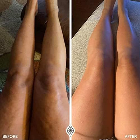 FasciaBlaster - Óleo Blaster por Ashley Black – Use com FasciaBlasting para Resultados Máximos – Óleo Queima Gordura Blaster e Arnica Calmante e Firmadores de Pele para Pós FasciaBlasting (Óleo)