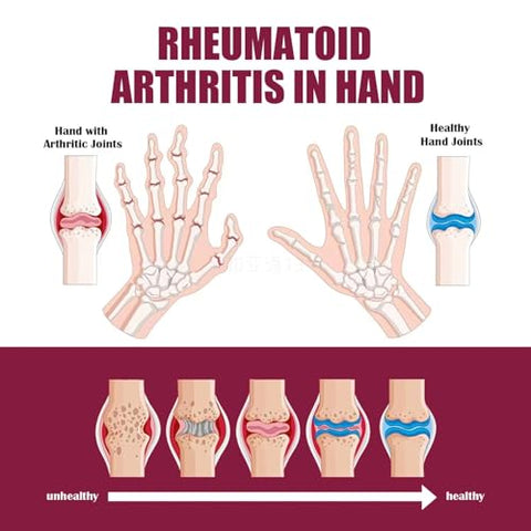 QUAAM - 2PCS Perfectx Joint – Fórmula Avançada para Articulações – 60 Cápsulas