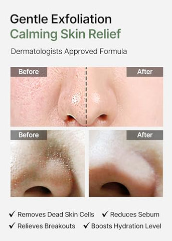 celimax - Celimax Ji.Woo.Gae Heartleaf BHA Peeling Pad Edição Dupla | Extratos de Heartleaf, Pads Esfoliantes, Peelings Faciais, Hidratante, Para Pele Problemática