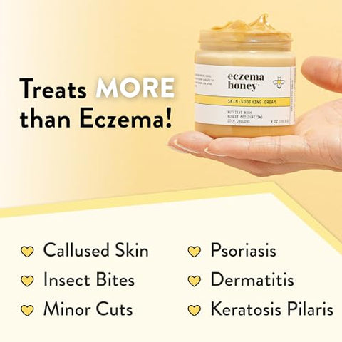 Creme Orgânico ECZEMA HONEY Original para Alívio da Pele – Mãos – 100g