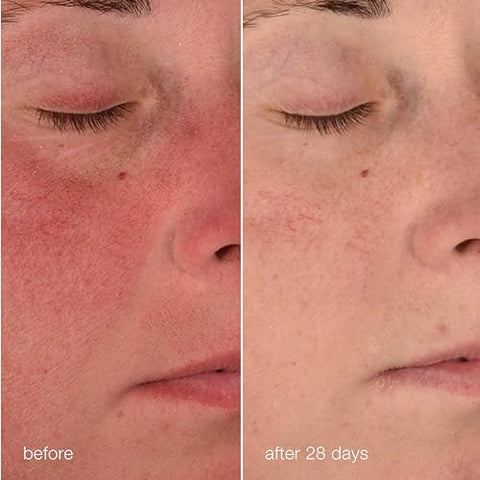 Creme Reparador Estabilizador Dermalogica, Hidratante Facial para Pele Sensível com Cica – Fortalece, Suaviza e Repara a Barreira da Pele, 50ml