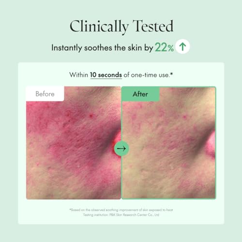 Centella Serum Coreano Centella, Todos os Tipos de Pele, Ampola, Calmante, Facial, Vegano – 30ml - PURITO
