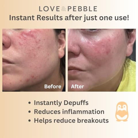 Love & Pebble - Beauty Pops by Love: Deliciosos Doces de Beleza com Colágeno – 100g