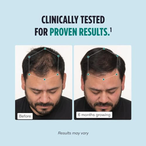 Men: Crescimento Capilar Testado Clinicamente | Cabelos Mais Espessos e Couro Cabeludo Saudável | Recomendado por Dermatologistas | 1 Mês de Uso - Nutrafol