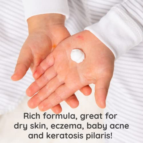 Loção de Coco Batida para Eczema, Pele Seca, Acne do Bebê, KP | Óleo de Coco Orgânico, Manteiga de Karité, Vitamina E | Fragrância Leve e Natural | Compatível com a UE, Vegano - Bubbsi