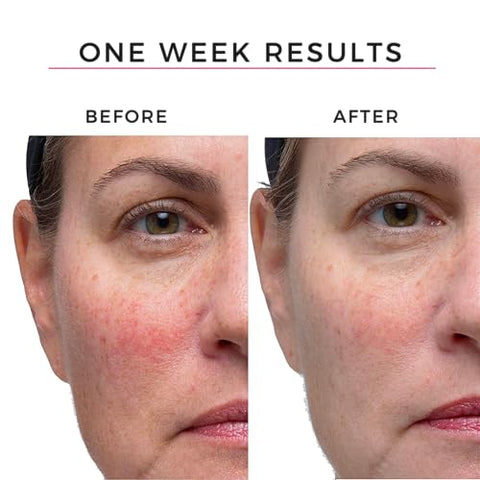 Soro Facial Hey Honey Skincare Good Morning para Pele Madura | Hidratante e Protetor de Barreira Cutânea | com Ácido Hialurônico, Retinil | Livre de Sensibilidade 30ml