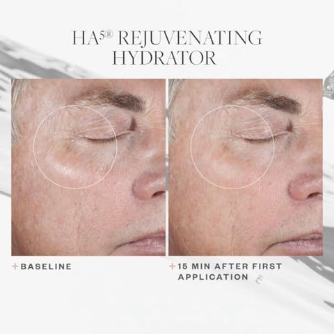 HA5 Rejuvenating Hydrator: Sérum de Ácido Hialurônico para o Rosto com Cinco Tipos de Ácido Hialurônico que Suaviza Linhas Finas e Rugas, Para Todos os Tipos de Pele, 60 ml - SkinMedica
