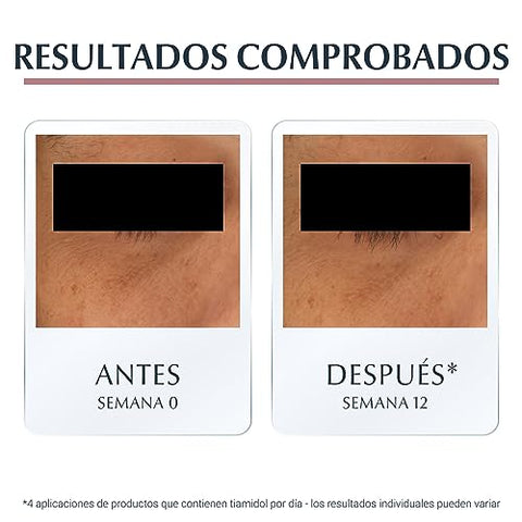 Face Antipigment Creme Contorno de Olhos 15ml – Redução de Manchas e Hidratação - Eucerin