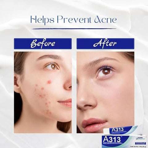 Generic - A313 Creme Retinol – Vitamina a Pommade 200.000 ui – 50g – (2 UNIDADES)