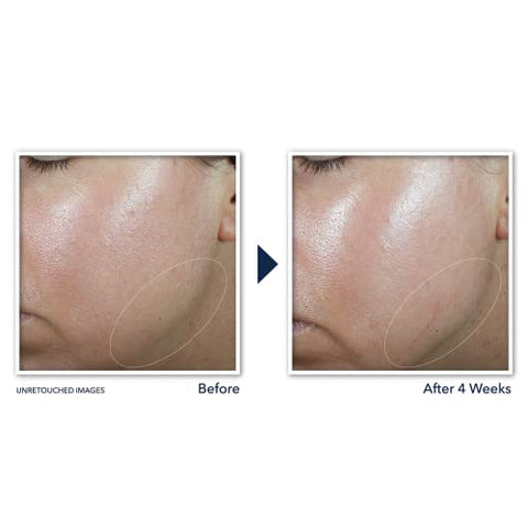 Derm Correxion Creme para Pescoço com Ácido Hialurônico e Retinol Avançado para Firmeza Visível – 50g - RoC