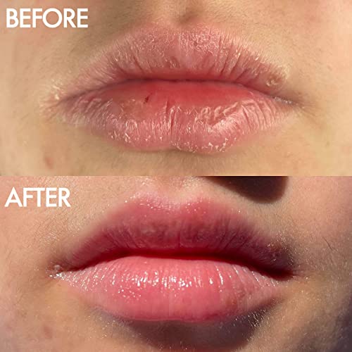 101 Ointment Multi-Balm Coconutter – Bálsamo Labial Frutado com Óleo de Vitamina E e Lanolina para Hidratação Labial – Bálsamo Labial de Lanolina com Sabor Natural para Lábios Muito Secos – 10g - Lanolips