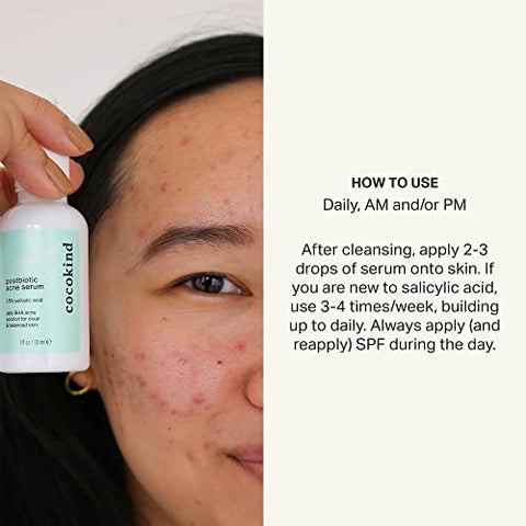 Serum Pós-Biótico para Acne, Serum de Ácido Salicílico e Esfoliante Líquido BHA – Serum Esfoliante, Iluminador e Hidratante - Cocokind