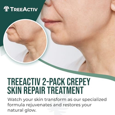 Tratamento Reparador para Pele Enrugada, 2-Pack, Creme Firmador para Rosto e Pescoço, Loção Firmadora e Tonificante com Ácido Hialurônico, Tratamento para Pele Enrugada para Hidratar Pele Seca - TreeActiv