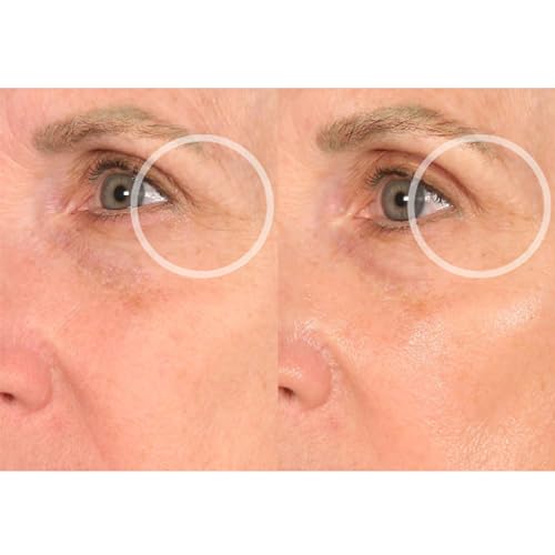 Beauty Eye: Creme para os Olhos com Ácido Hialurônico e Colágeno – 15g - SiO
