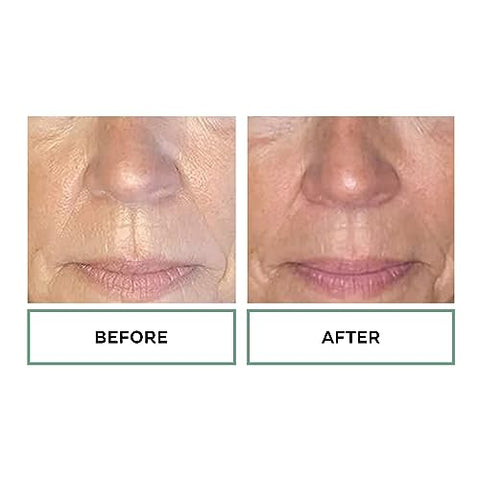 Creme Replenix Ácido Glicólico 20% Resurfacing, Hidratante – 50g